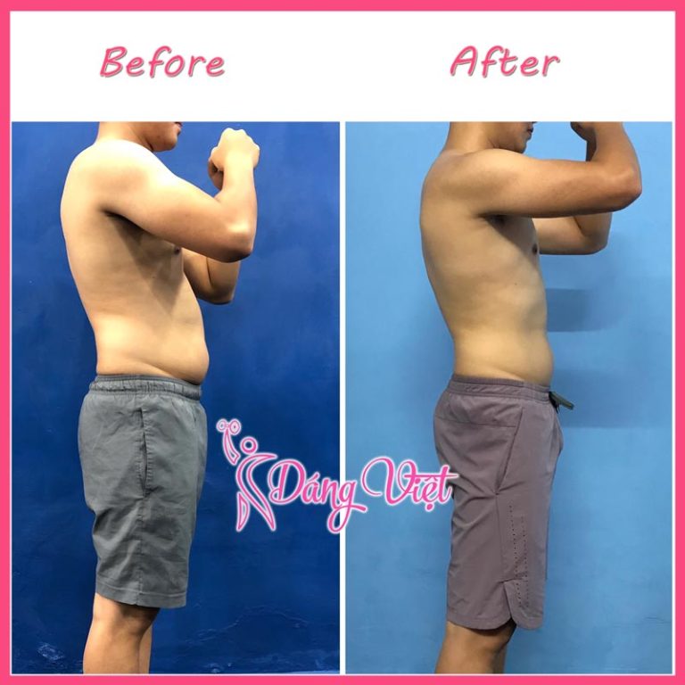 Anh Ngọc: Giảm mỡ - 72 buổi PT