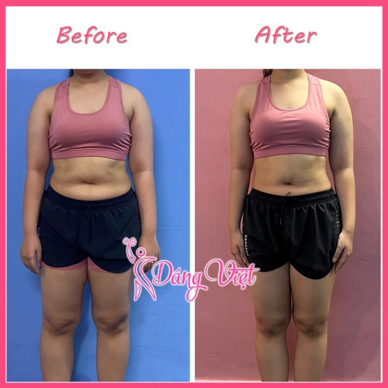 Thúy My: Giảm mỡ toàn thân - 36 buổi PT